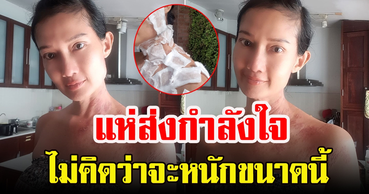 ดี้ ชนานา เผยภาพน่าตกใจ