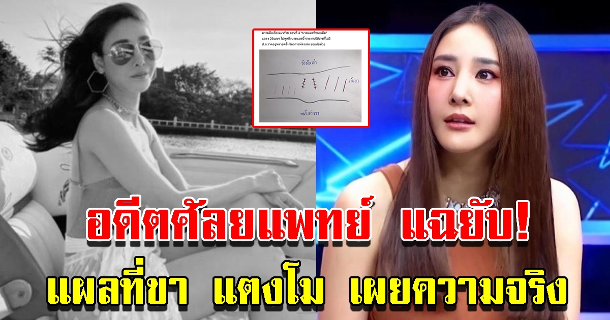 อดีตศัลยแพทย์ แฉยับ แผลที่ขาแตงโม