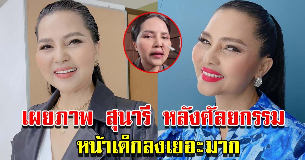 เผยภาพ สุนารี หลังทำสวยครบ 1 เดือน