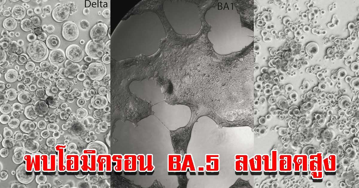 ดร.อนันต์ เผย ทีมวิจัยออสเตรเลีย พบโอมิครอน BA.5 เข้าเซลล์คล้ายเดลตา