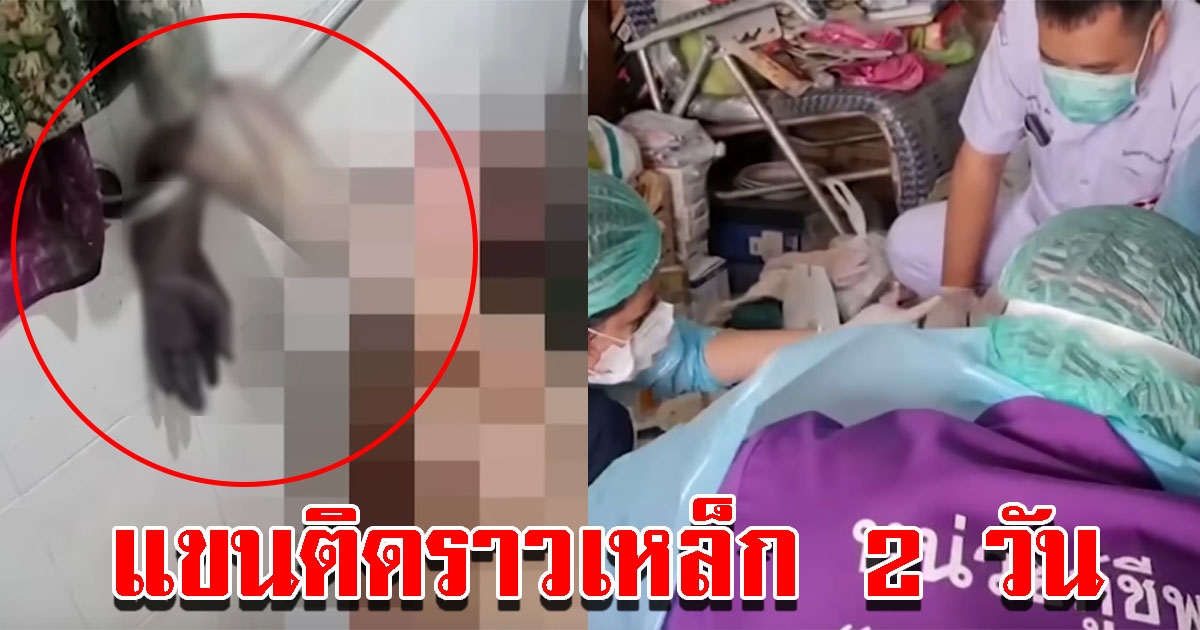 ยายวัย 80 ปี ลื่นล้มในห้องน้ำ แขนติดราวเหล็ก 2 วัน