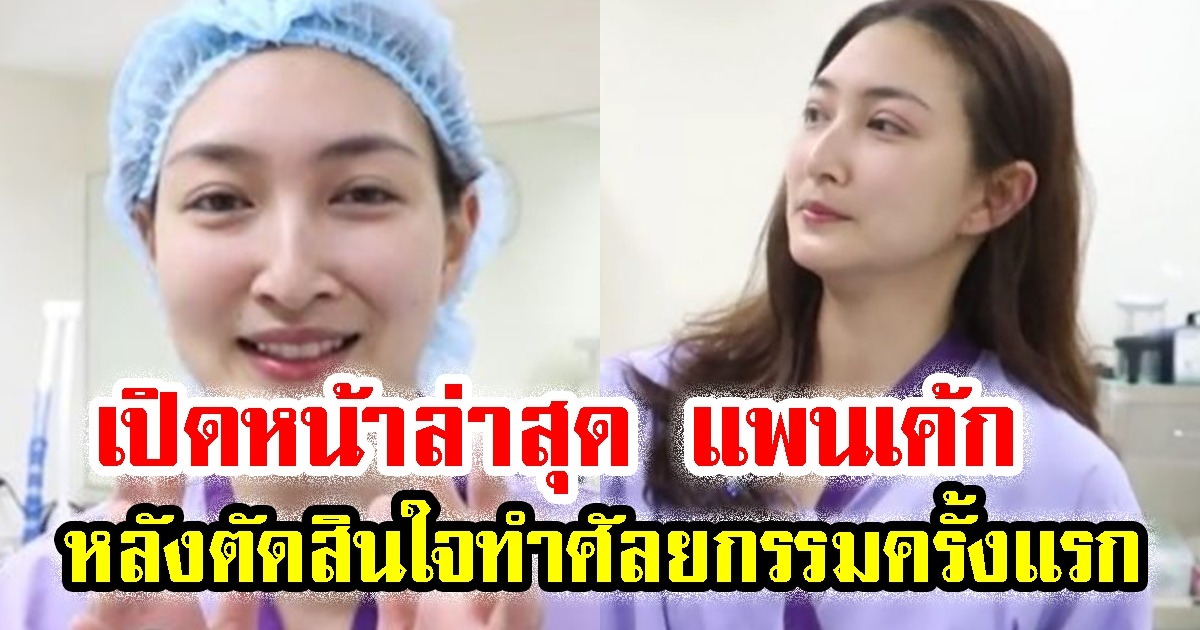 เปิดหน้าล่าสุด แพนเค้ก เขมนิจ หลังตัดสินใจทำศัลยกรรมครั้งแรก