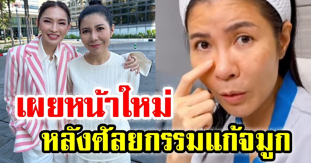 เปิดหน้าใหม่ ตุ๊ยตุ่ย หลังศัลยกรรม วัย 49 ปี สวยจำแทบไม่ได้