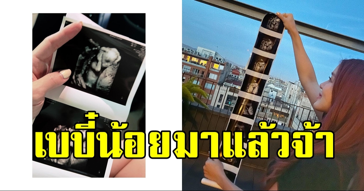 ดารา-พิธีกรสาวคนดัง ประกาศข่าวดีตั้งครรภ์ เบบี๋น้อยมาแล้วจ้า