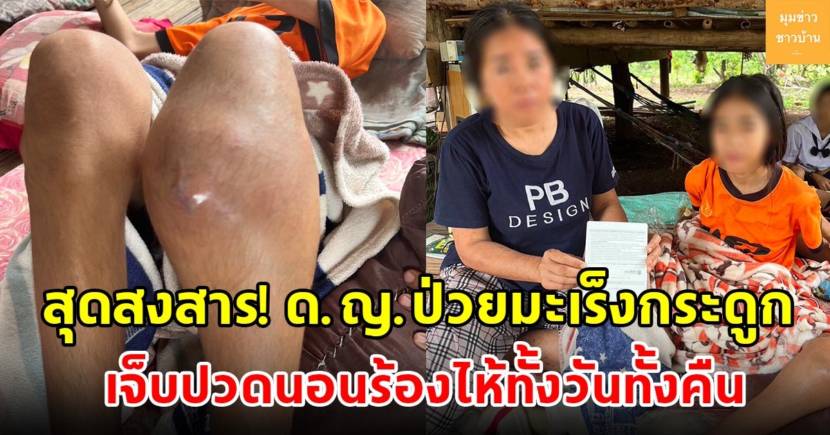 สุดสงสาร เด็กหญิงวัย 14 ปี ป่วยมะเร็งกระดูก เจ็บปวดนอนร้องไห้ทั้งวันทั้งคืน บ้านฐานะยากจนวอนช่วยเหลือ