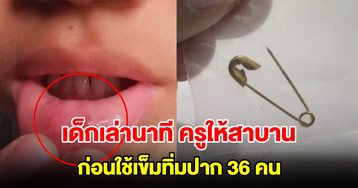 เด็กนักเรียนเล่านาที ครูให้สาบาน ก่อนใช้เข็มทิ่มปาก 36 คน เป็นแผลชัดเจน