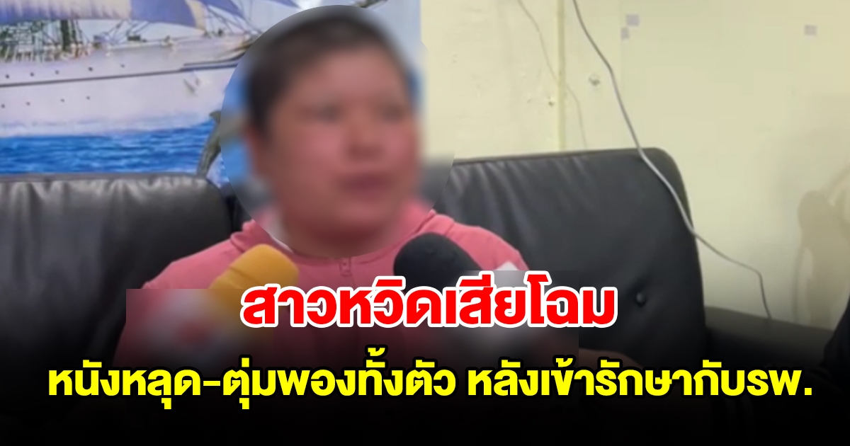สาวหวิดเสียโฉม หนังหลุด ตุ่มพองทั้งตัว หลังเข้ารักษากับโรงพยาบาล