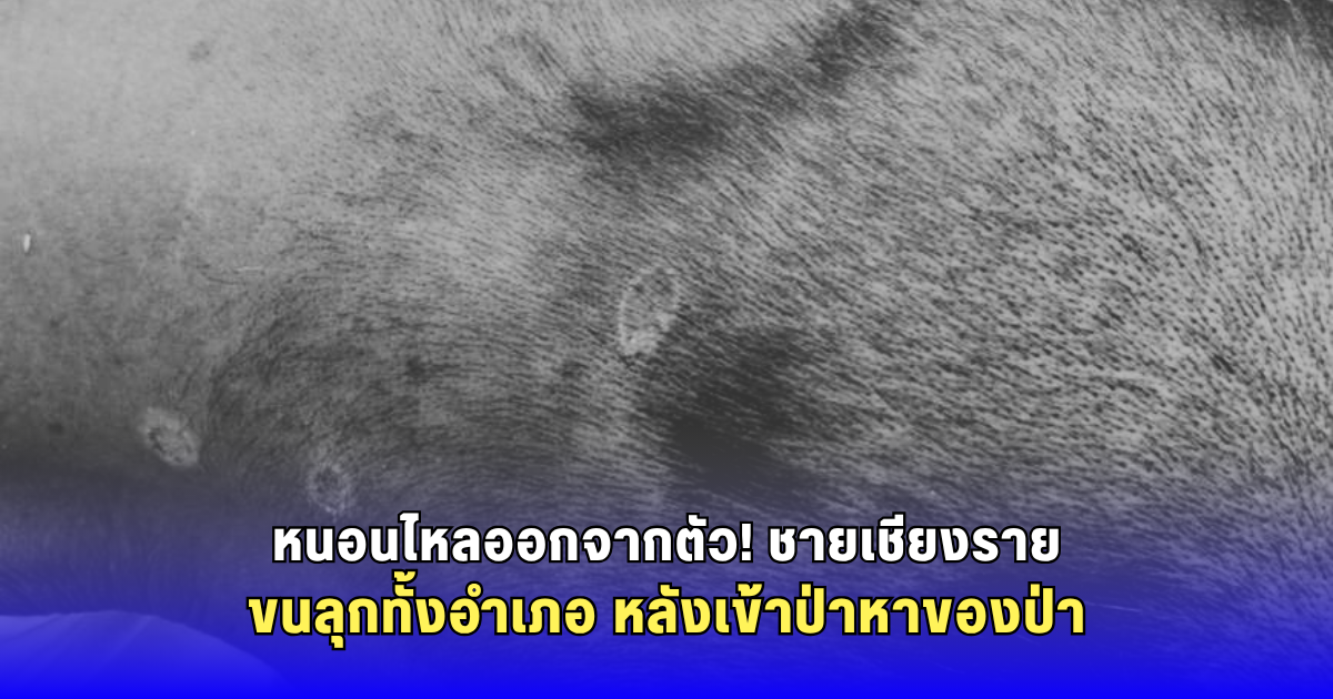 ขนลุกทั้งอำเภอ! ชายวัย 59 ถูกหนอน-แมลงไต่ตามร่างกาย หลังเข้าป่าหาของป่า ญาติต้องเร่งนำส่ง รพ.แม่จัน