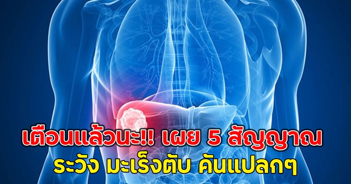เตือนแล้วนะ!! เผย 5 สัญญาณ ระวัง มะเร็งตับ คันแปลกๆ