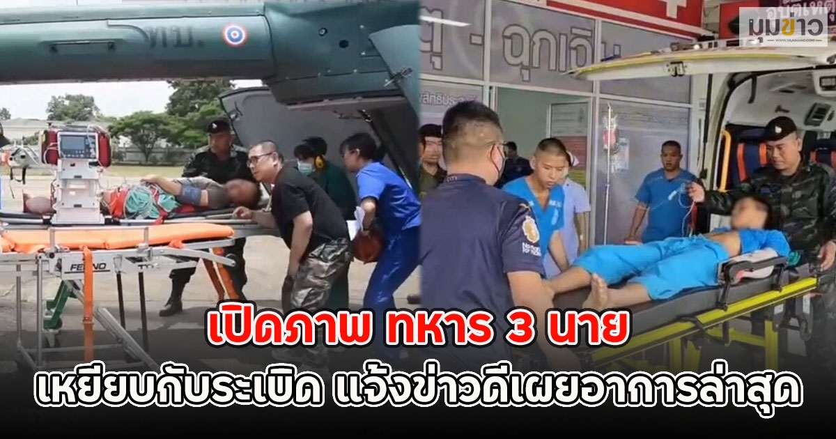 เปิดภาพ ทหาร 3 นาย เหยียบกับระเบิด แจ้งข่าวดีเผยอาการล่าสุด