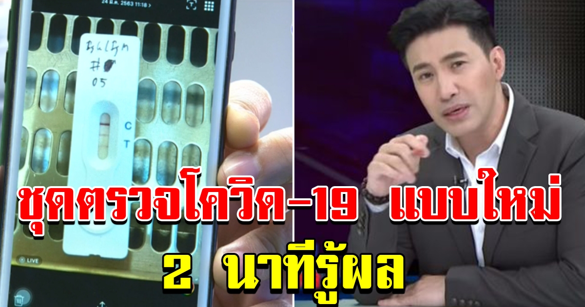 หนุ่ม กรรชัย โชว์ผลตรวจ