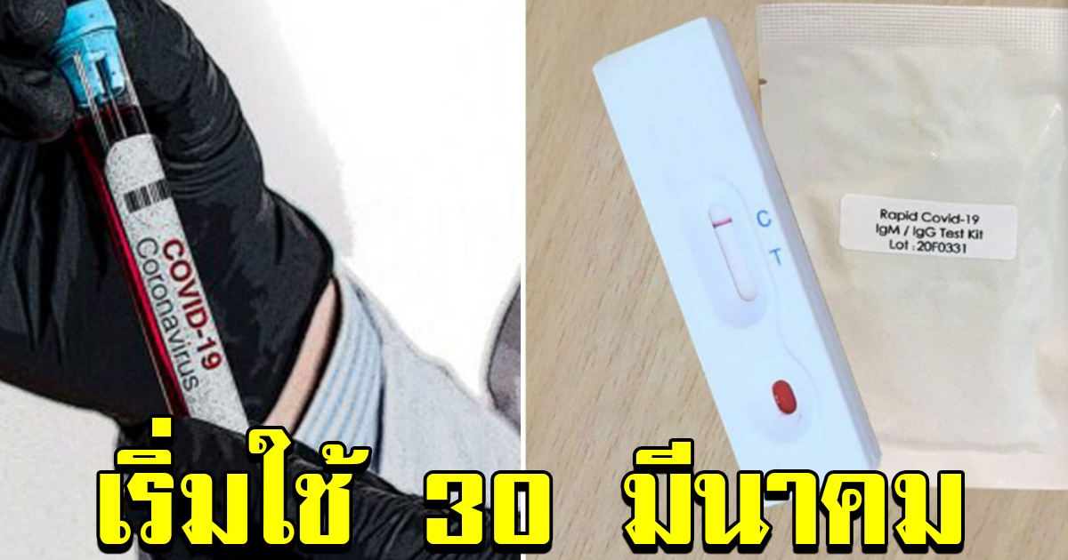 จุฬาทำสำเร็จ ชุดตรวจ10นาทีรู้ผล