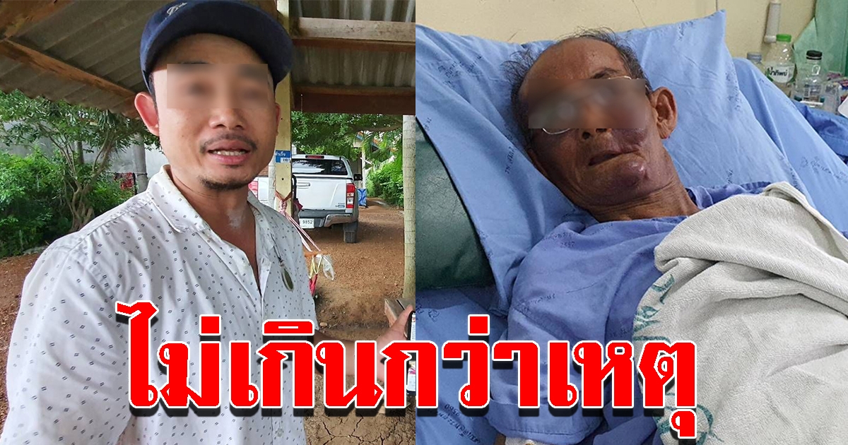 ลูกชายขอสังคมเห็นใจ ต่อยพ่อแท้ๆหน้าตาปูดบวมเลือดคั่งในสมอง