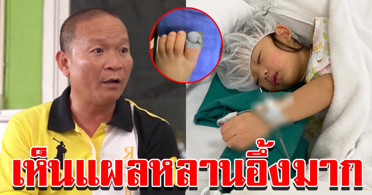 หม่ำ เล่าเหตุการณ์น้ำตาซึม เห็นภาพหลานถูกโต๊ะกระจกหล่นใส่ นิ้วโป้งเท้าขาด