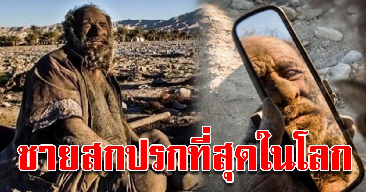 เปิดภาพ ชายที่ได้รับฉายาว่า สกปรกที่สุดในโลก