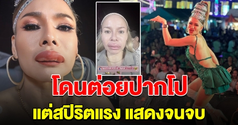 ตกใจทั้งงาน นักร้องดัง โดนต่อยปากโป แต่สปิริตแรงเล่นคอนเสิร์ตจนจบ