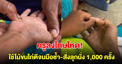 ผู้ปกครองสุดทน! หลานถูกครูใช้ไม้ขนไก่ตีจนมือเป็นแผลช้ำ สั่งให้ลุกนั่ง 1,000 ครั้ง