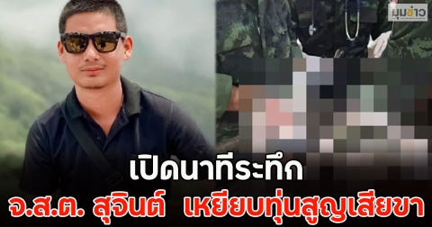 เปิดนาทีระทึก จ.ส.ต. สุจินต์  เหยียบทุ่นสูญเสียขา