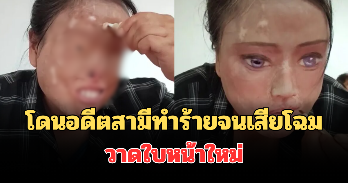 ยอมใจเลยจริงๆ! สาวจีน โดนอดีตสามีทำร้ายจนเสียโฉม วาดใบหน้าใหม่ เผยคำพูดซึ้งกินใจ