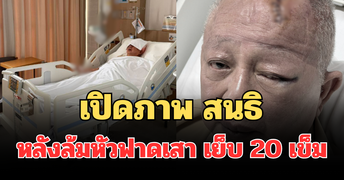 ใจหาย! เปิดภาพล่าสุด สนธิ ลิ้มทองกุล หลังล้มหัวฟาดเสา เย็บ 20 เข็ม