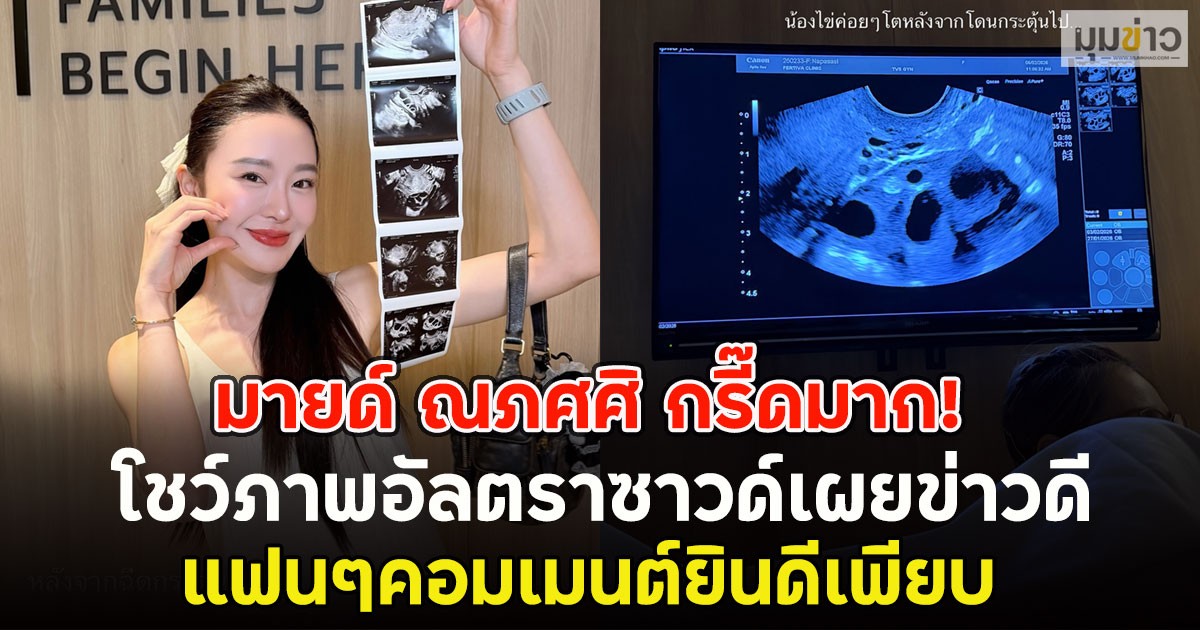 มายด์ ณภศศิ กรี๊ดมาก!  โชว์ภาพอัลตราซาวด์เผยข่าวดี แฟนๆคอมเมนต์ยินดีเพียบ