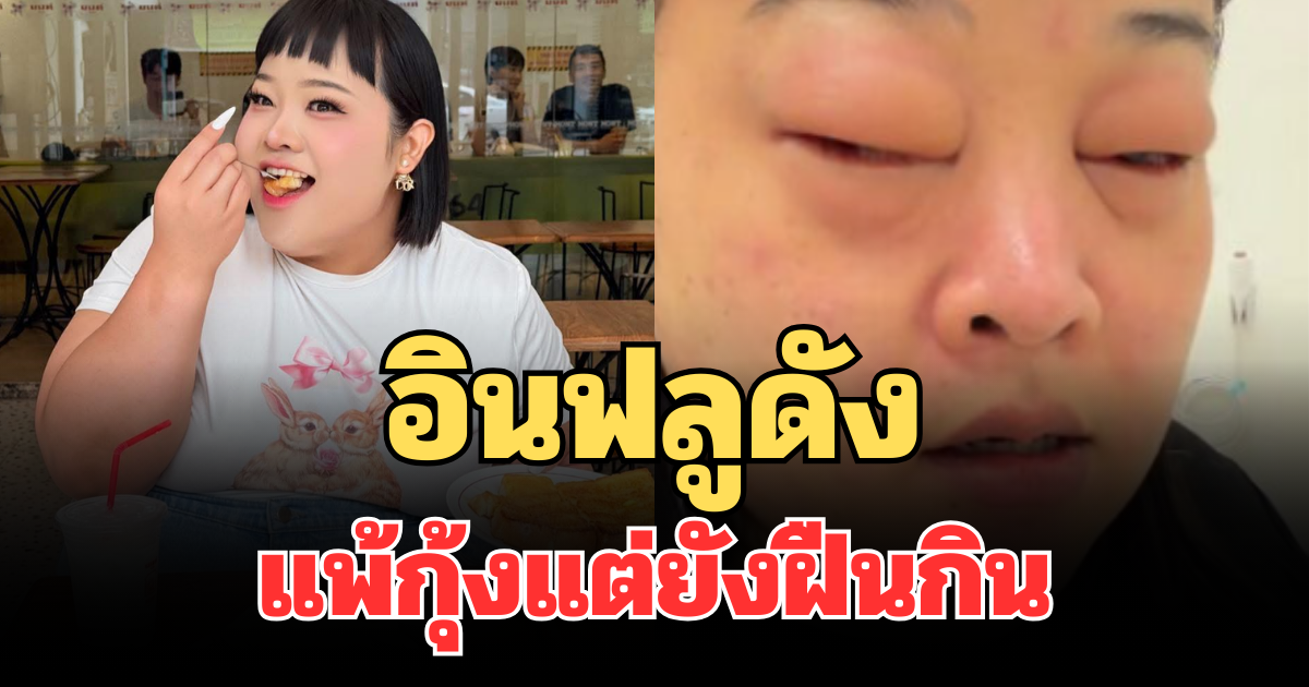 อุทาหรณ์! อินฟลูดังแพ้กุ้งแต่ยังฝืนกิน สุดท้ายหามส่งรพ.