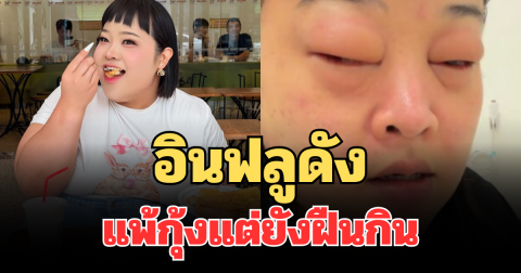 อุทาหรณ์! อินฟลูดังแพ้กุ้งแต่ยังฝืนกิน สุดท้ายหามส่งรพ.