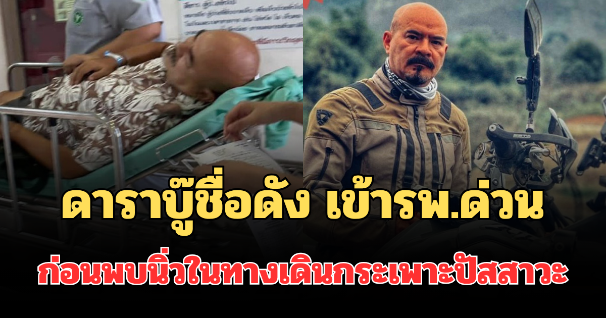 ดาราบู๊ชื่อดัง เข้ารพ.ด่วน ก่อนพบนิ่วในทางเดินกระเพาะปัสสาวะ