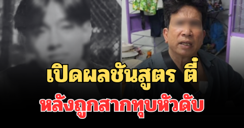 เปิดผลชันสูตร ตี๋ เหยื่อช่างเอก หลังถูกสากทุบหัวดับ