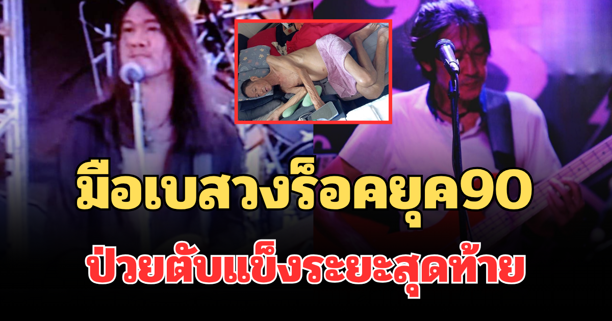 น่าเป็นห่วงมาก! มือเบสวงร็อคยุค90 ป่วยตับแข็งระยะสุดท้าย อาการวิกฤต