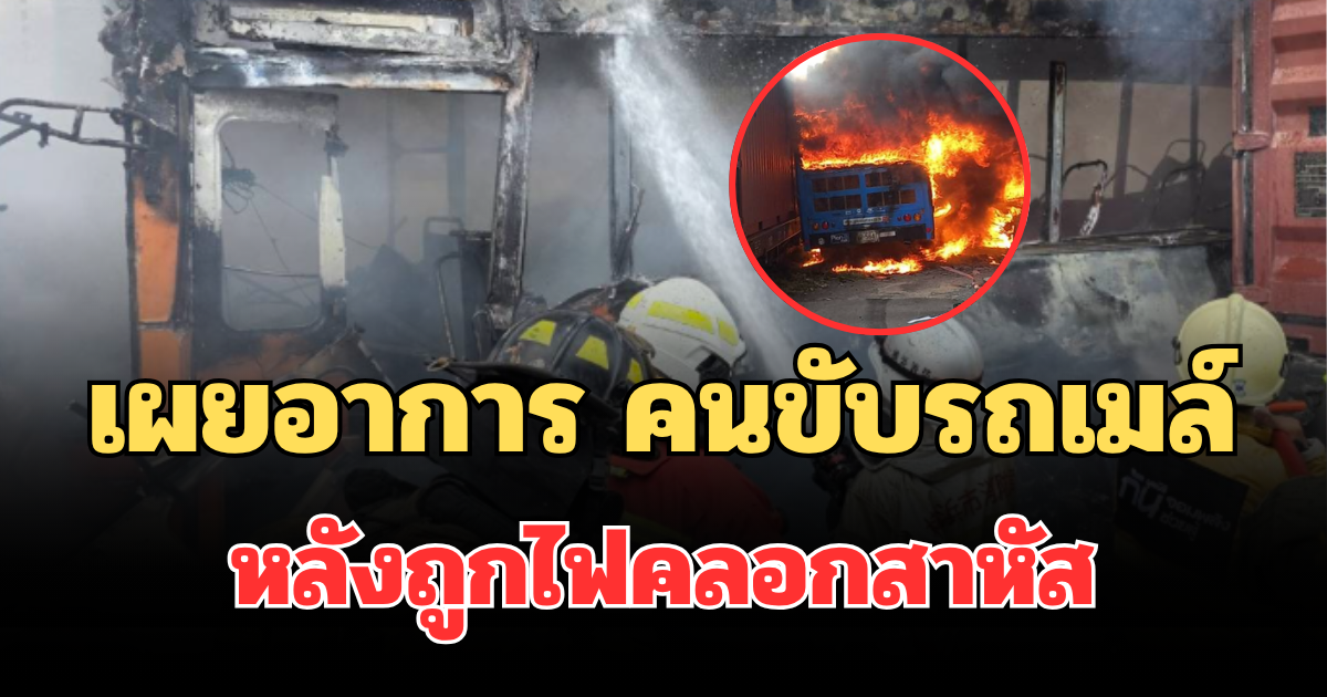 เผยอาการล่าสุด คนขับรถเมล์ หลังถูกไฟคลอกสาหัส