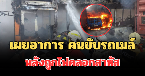 เผยอาการล่าสุด คนขับรถเมล์ หลังถูกไฟคลอกสาหัส