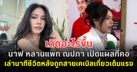 เกิดอะไรขึ้น นาฟ หลานแพท ณปภา เปิดแผลที่คอ เล่านาทีชีวิตหลังถูกสายเคเบิลเกี่ยวเต็มแรง