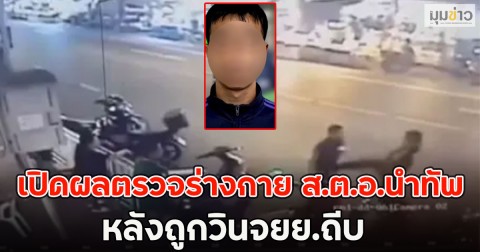 เปิดผลตรวจร่างกาย ส.ต.อ.นำทัพ หลังถูกวินจยย.ถีบ
