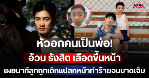 หัวอกคนเป็นพ่อ! อ้วน รังสิต เลือดขึ้นหน้า เผยนาทีลูกถูกเด็กแปลกหน้าทำร้ายจนบาดเจ็บ