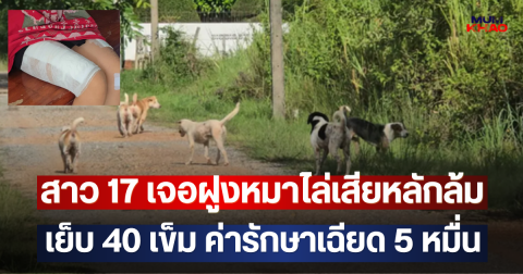 สาว 17 เจอฝูงหมาไล่เสียหลักล้ม เย็บ 40 เข็ม ค่ารักษาเฉียด 5 หมื่น