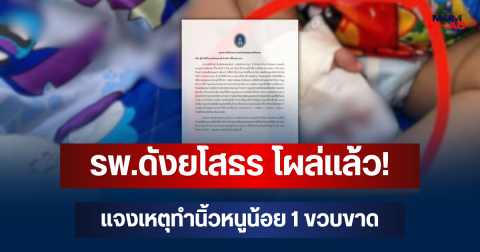 รพ.ดังยโสธร โผล่แล้ว! แจงเหตุผู้ช่วยพยาบาลพลาด ทำนิ้วหนูน้อย 1 ขวบขาด