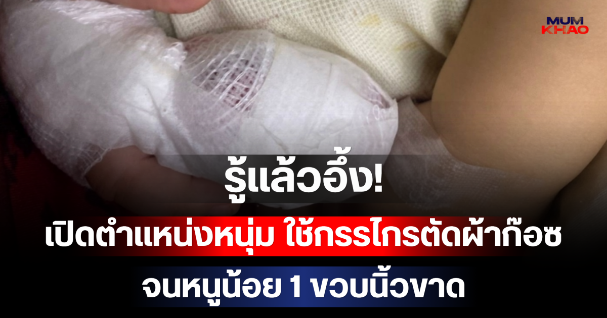 รู้แล้วอึ้ง! เปิดตำแหน่งหนุ่ม ใช้กรรไกรตัดผ้าก๊อซจนหนูน้อย 1 ขวบนิ้วขาด พีกสุดเรื่องวุฒิการศึกษาที่ใช้สมัครงาน