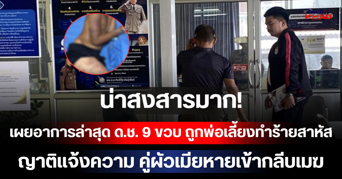 น่าสงสารมาก! เผยอาการล่าสุด ด.ช. 9 ขวบ ถูกพ่อเลี้ยงทำร้ายสาหัส ญาติแจ้งความ คู่ผัวเมียหายเข้ากลีบเมฆ